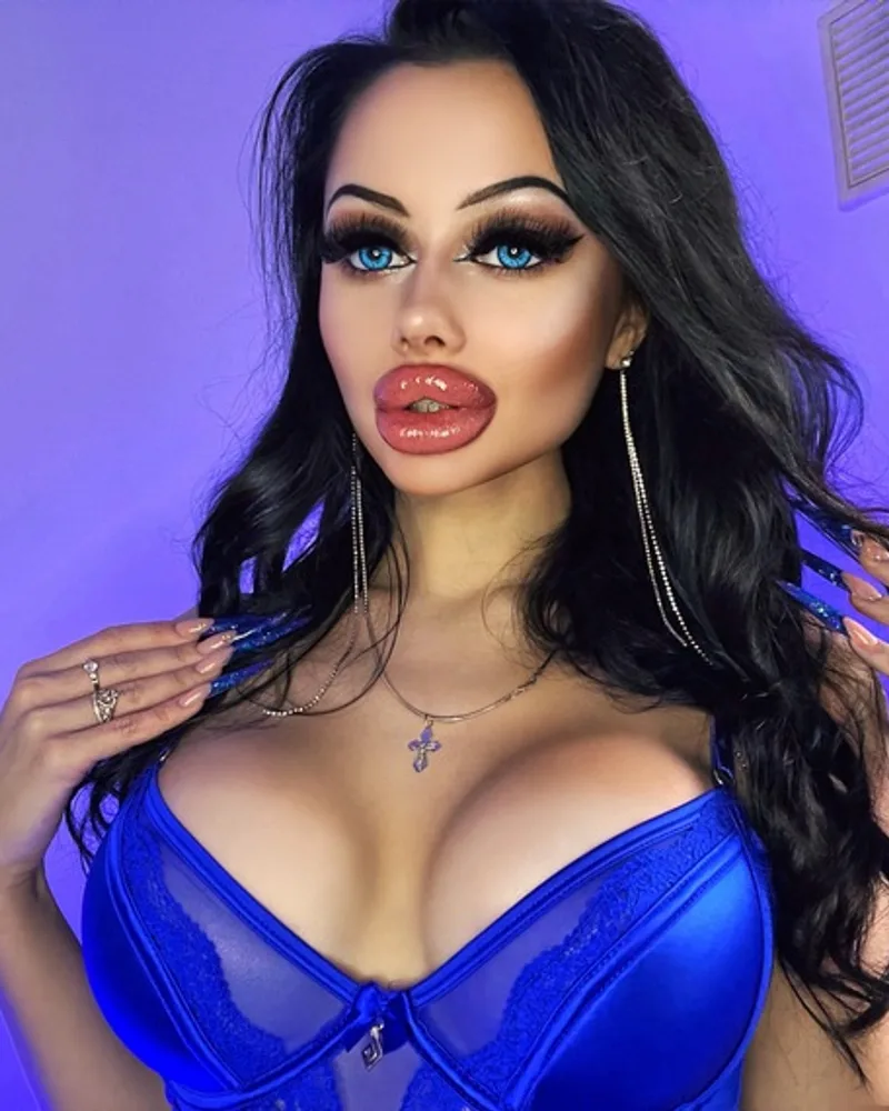 Allison