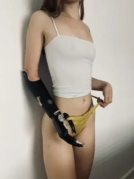 Amputeegirl
