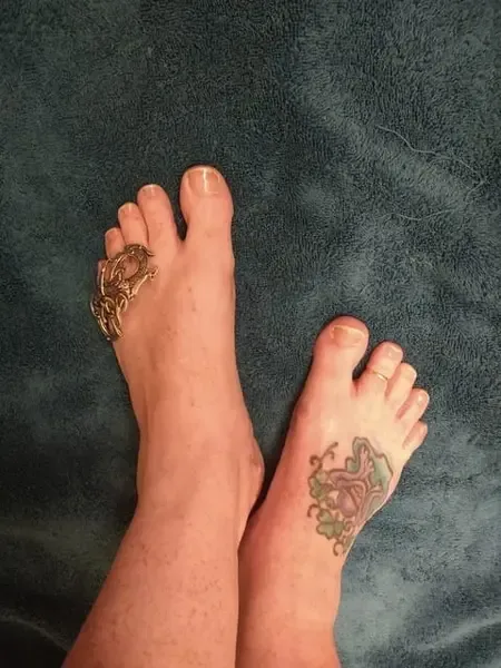 freckledfroggyfeet