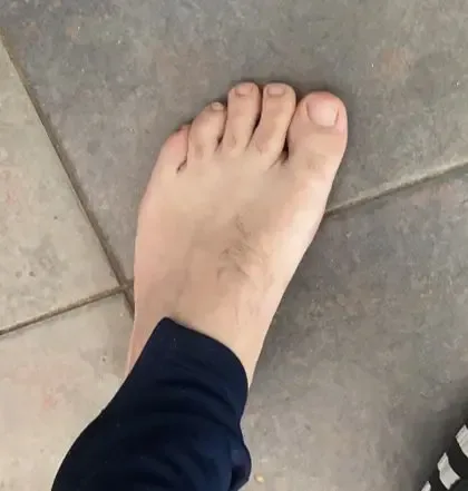 irishmanfeet
