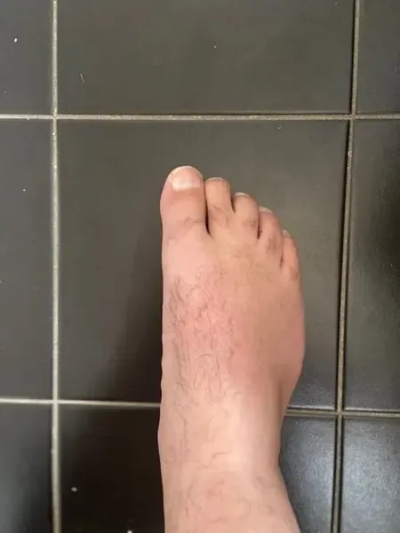 juicyfeethere