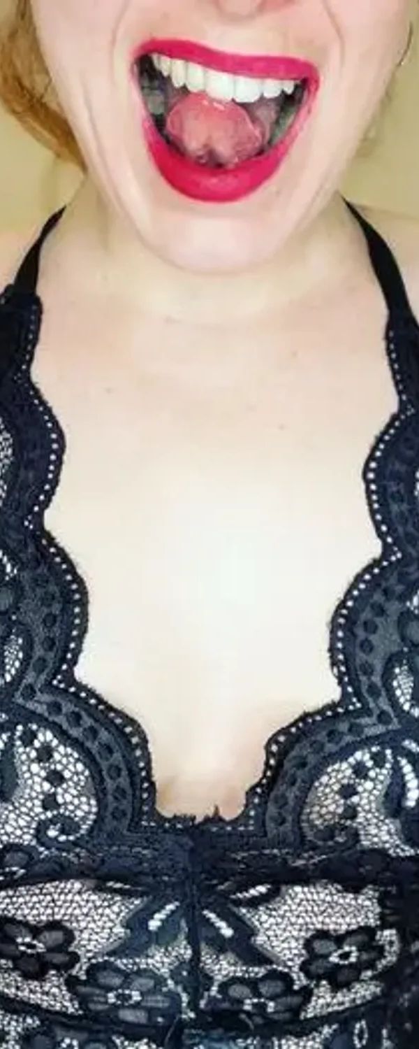 Freckles π OnlyFans photo 1