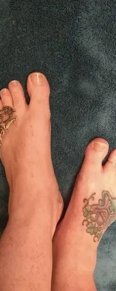 freckledfroggyfeet