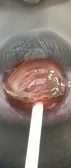lovelylumpsxxx